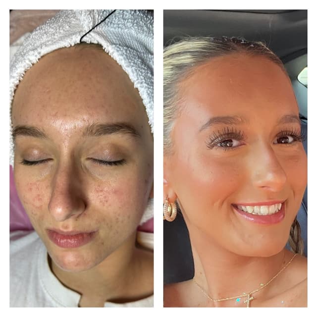 Procell 3 pack at Beauty by Gigi in Elmhurst, IL